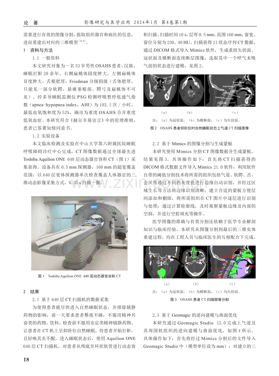 符合生理顺应性的OSAHS患者上气道及其周围软组织三维重建.pdf_第2页