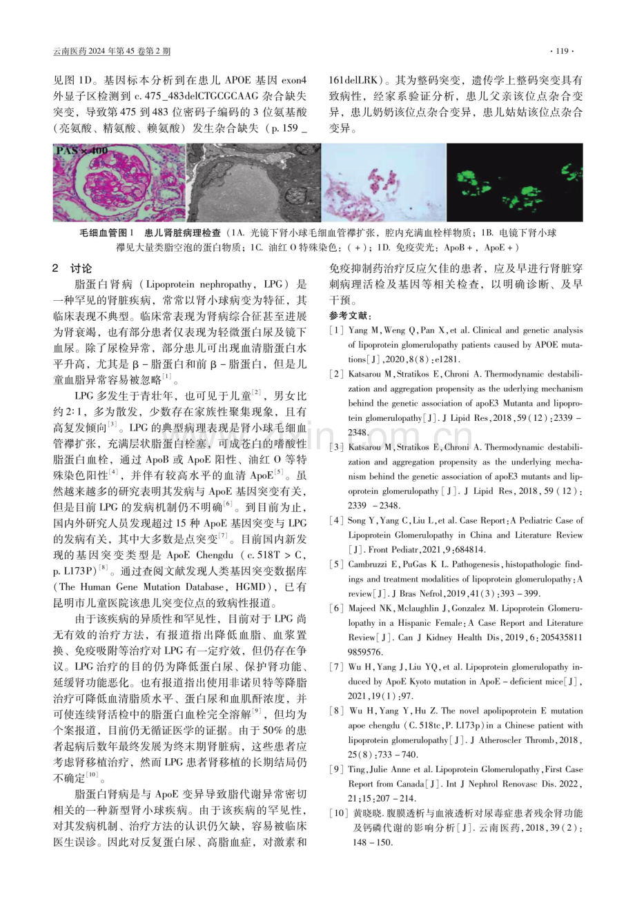 儿童脂蛋白肾病1例报道.pdf_第2页