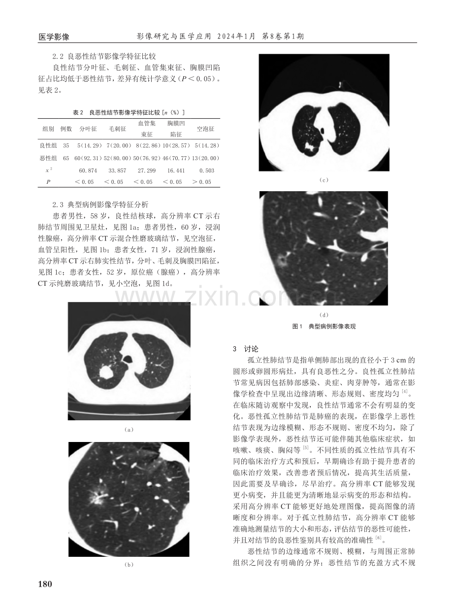 高分辨CT诊断孤立性肺结节的临床价值及影像特征分析.pdf_第2页