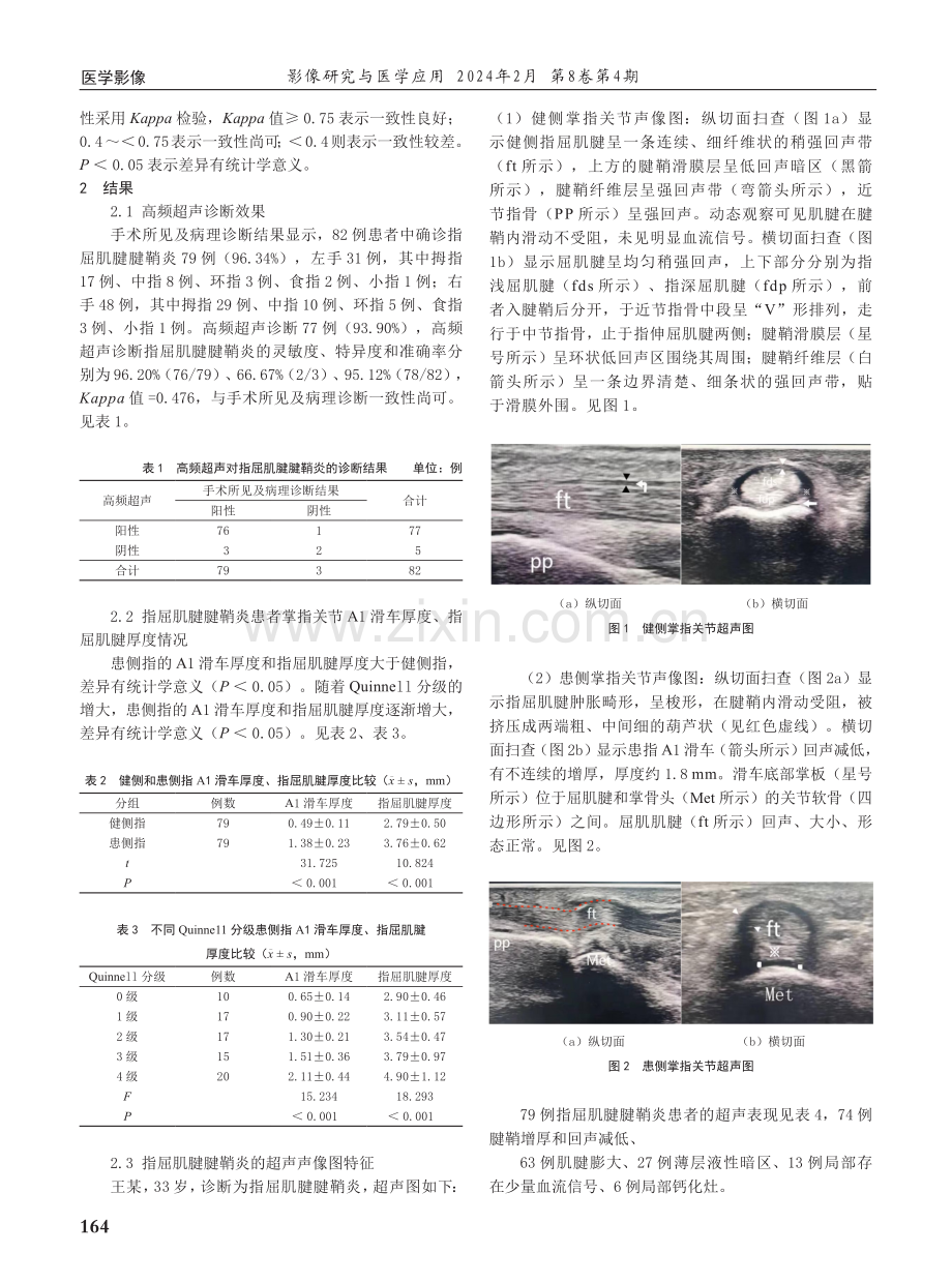 高频超声诊断指屈肌腱腱鞘炎的应用价值.pdf_第2页