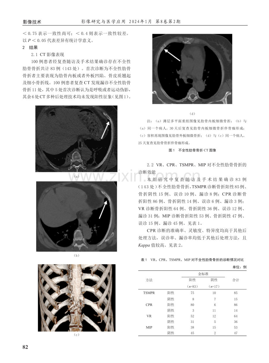 多层螺旋CT后处理技术在不完全性肋骨骨折中的应用价值.pdf_第2页