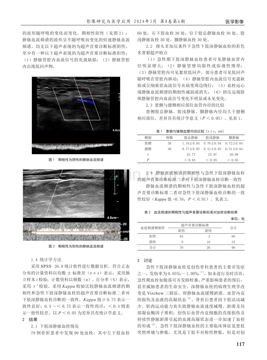 静脉血管内径及血流频谱的期相性在超声诊断急性下肢深静脉血栓中的应用价值.pdf_第2页