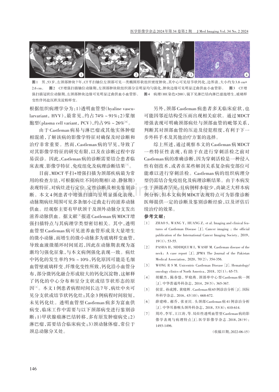 颈部透明血管型Castleman病MDCT表现与病理对照.pdf_第2页