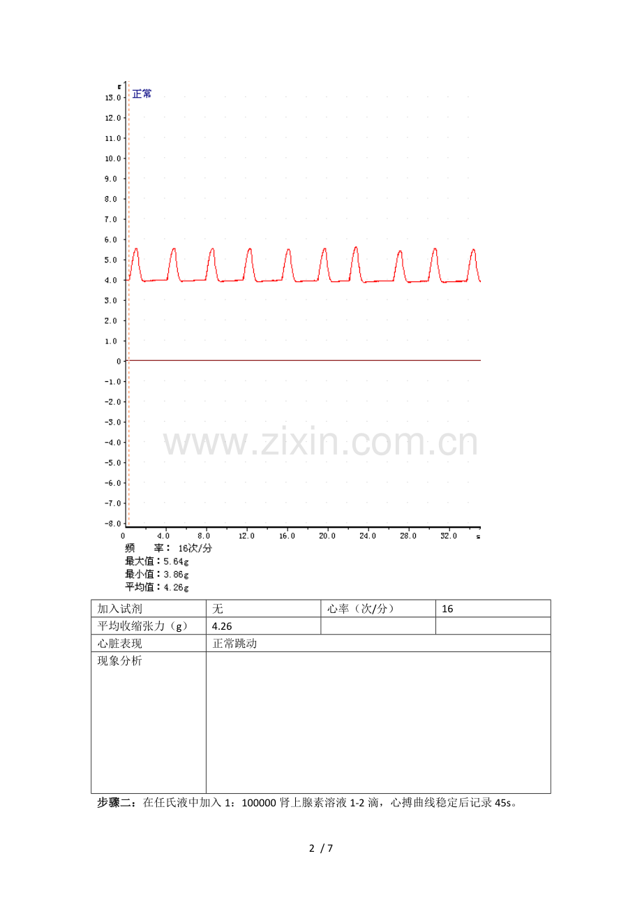 离体蟾蜍心脏灌流实验数据处理与分析.doc_第2页