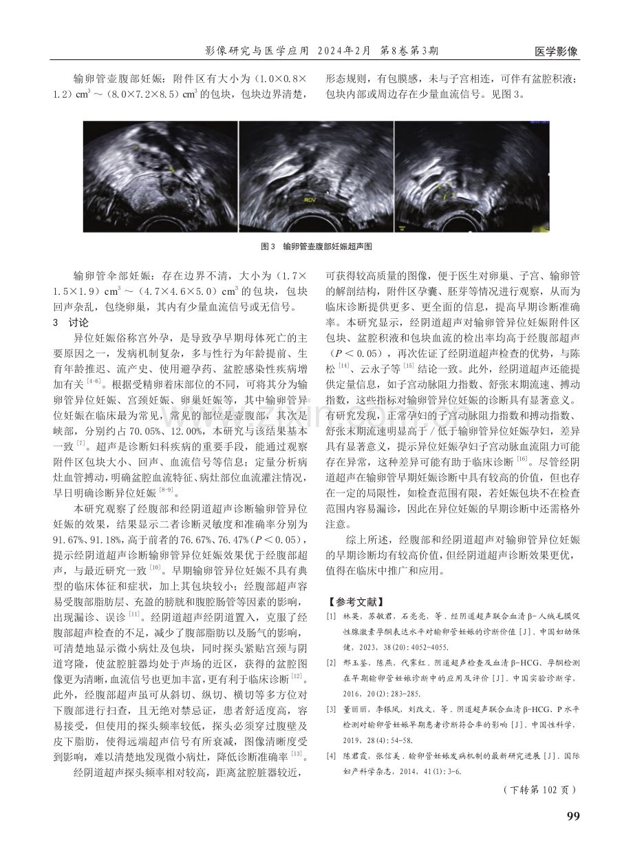 经阴道超声对输卵管异位妊娠的早期诊断价值.pdf_第3页