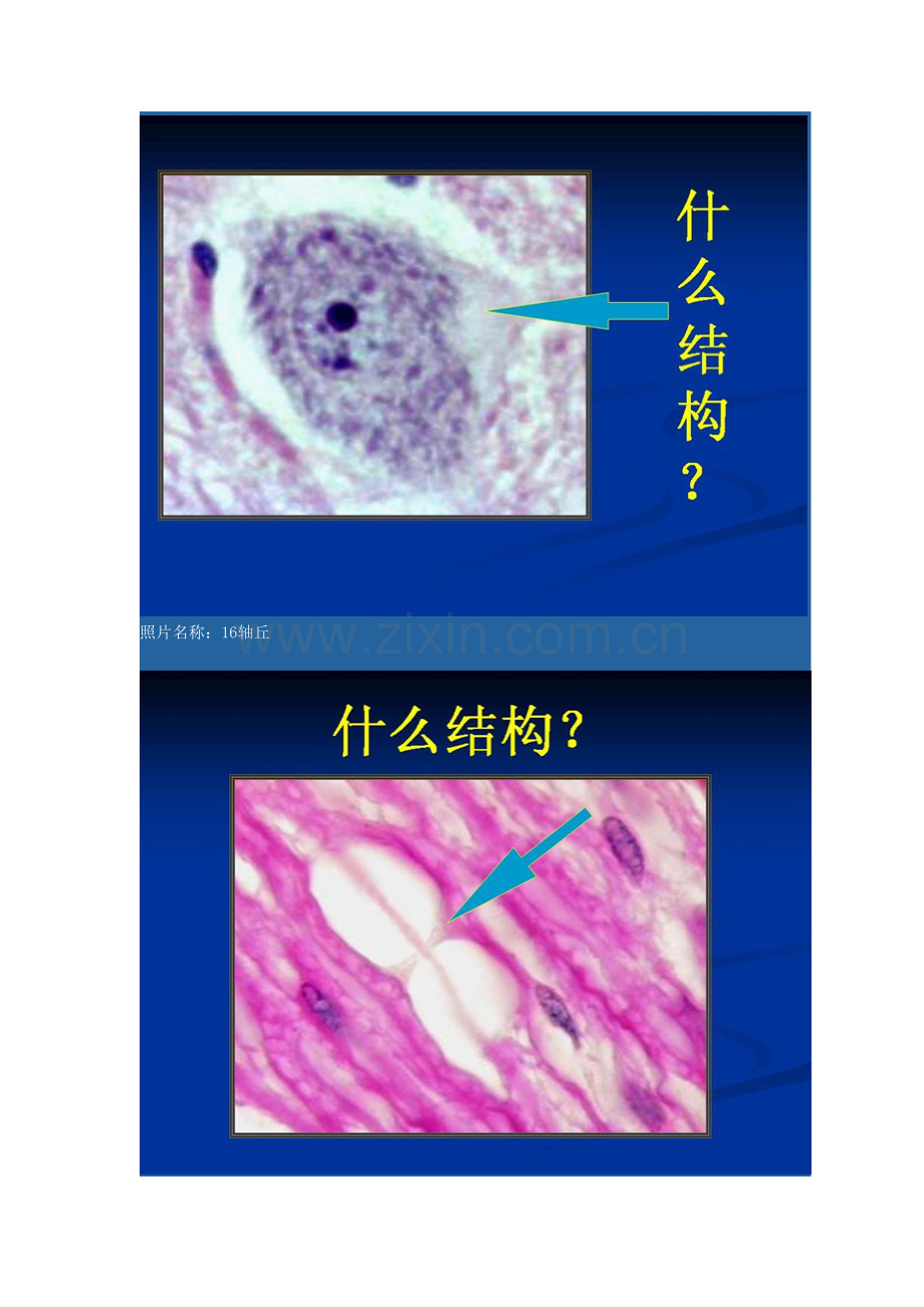 组织学与胚胎学实验考试图及答案!.doc_第3页