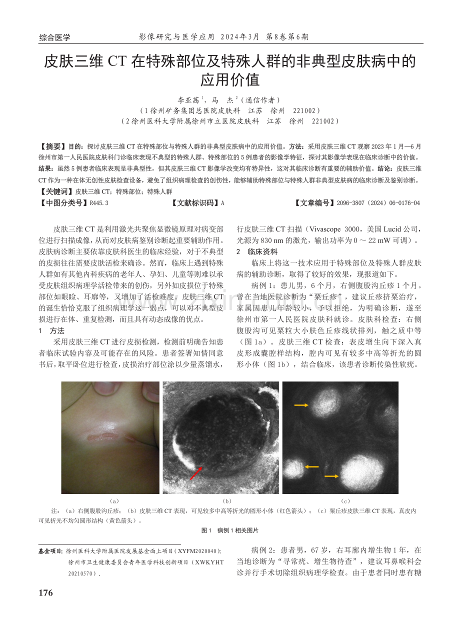 皮肤三维CT在特殊部位及特殊人群的非典型皮肤病中的应用价值.pdf_第1页