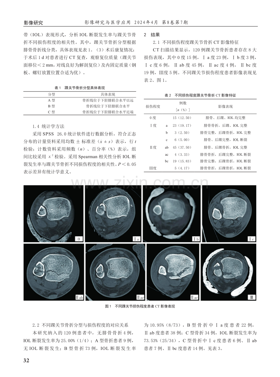 踝关节骨折CT表现与踝关节骨折分型的相关性研究.pdf_第2页