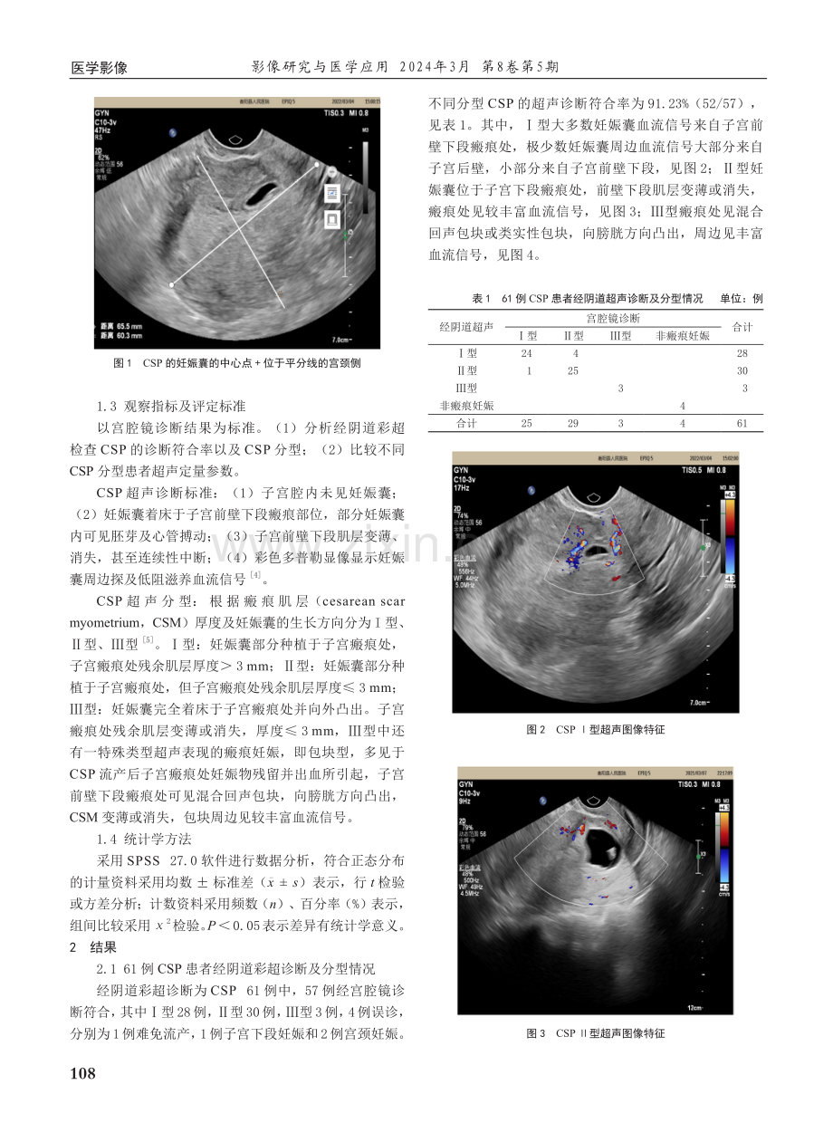 经阴道彩色多普勒超声对剖宫产瘢痕妊娠诊断及分型价值.pdf_第2页