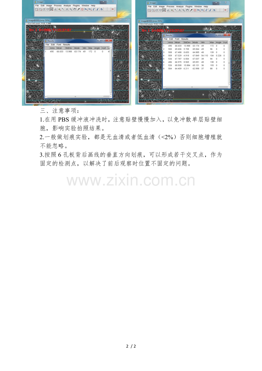 细胞迁移-划痕实验.doc_第2页