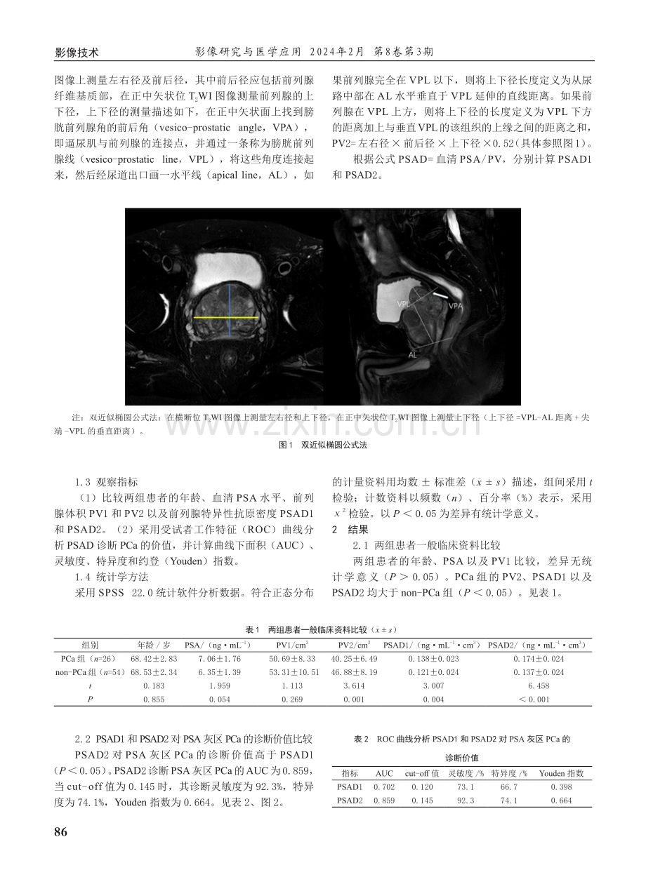 双近似椭圆公式测量法对前列腺特异性抗原灰区前列腺癌的诊断价值.pdf_第2页