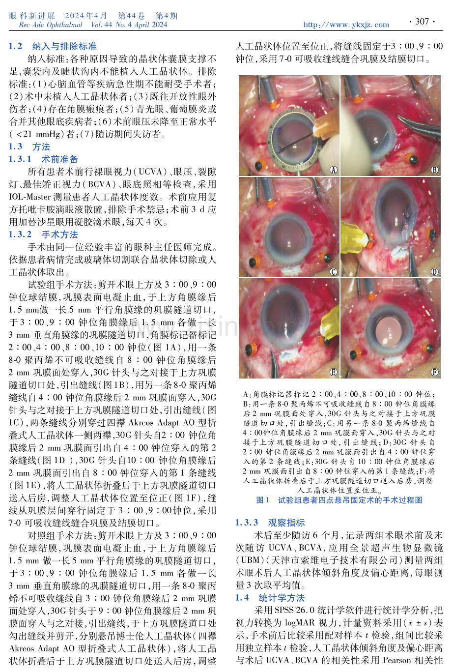 四点悬吊固定术后患者人工晶状体的倾斜与偏心情况及其与视力预后的关系.pdf_第2页