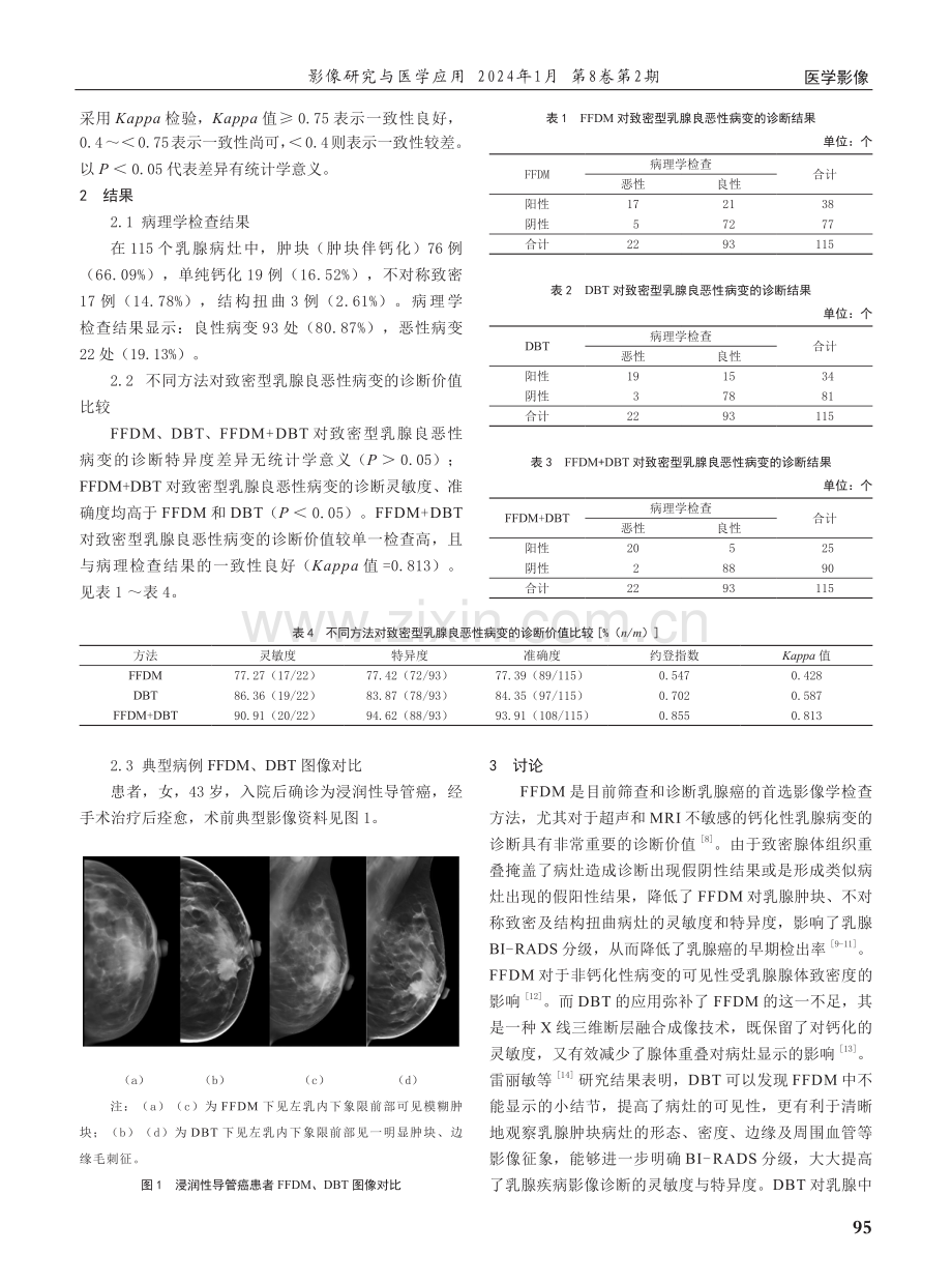 数字乳腺断层摄影、全数字化乳腺X线摄影对致密型乳腺良恶性疾病的诊断价值.pdf_第2页