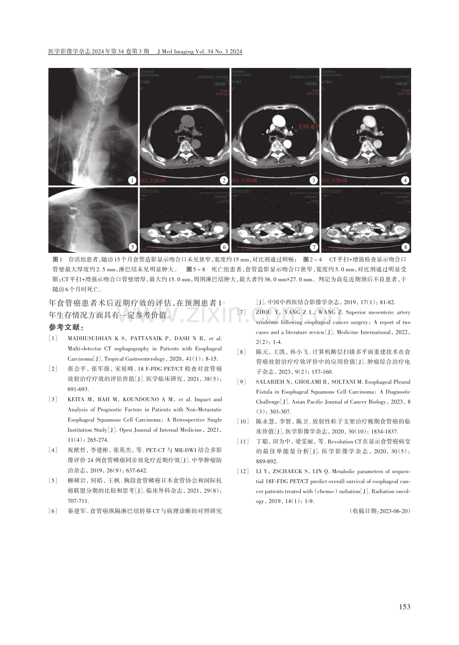 食管钡餐造影联合CT在老年食管癌患者术后的评估价值.pdf_第3页