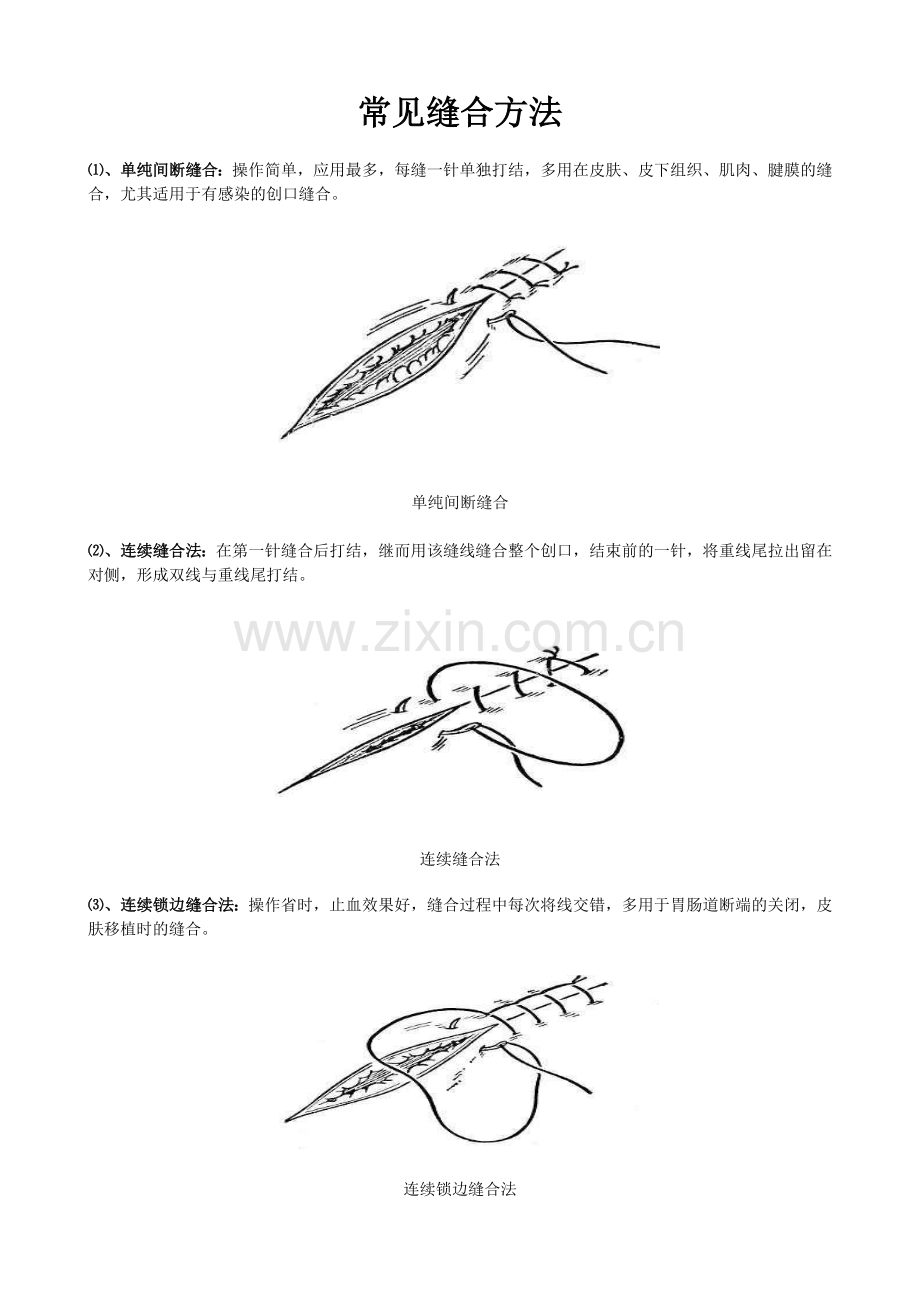 常见缝合方法.doc_第1页