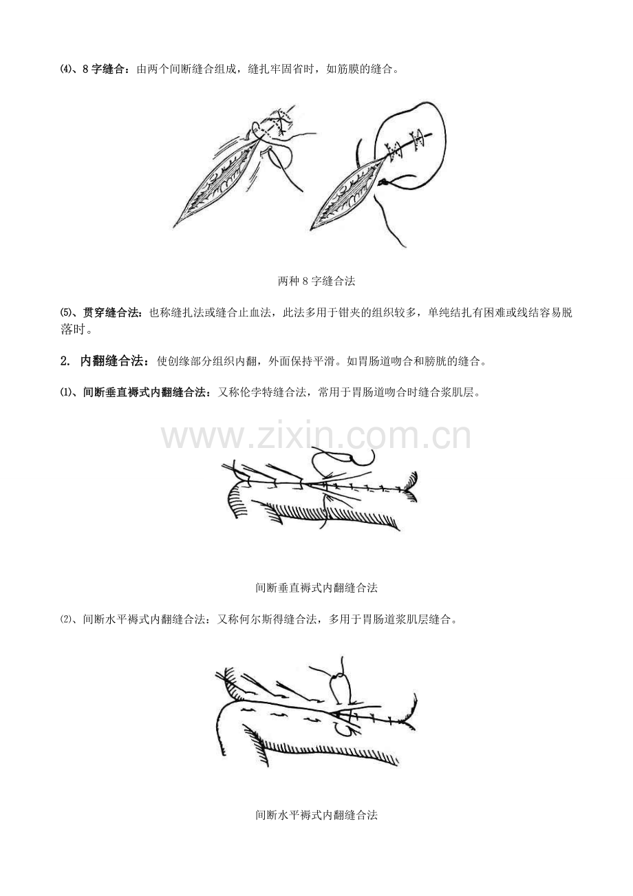 常见缝合方法.doc_第2页