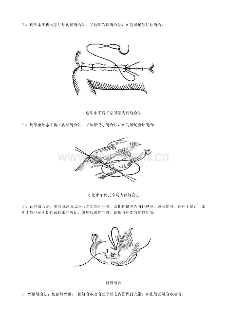 常见缝合方法.doc_第3页