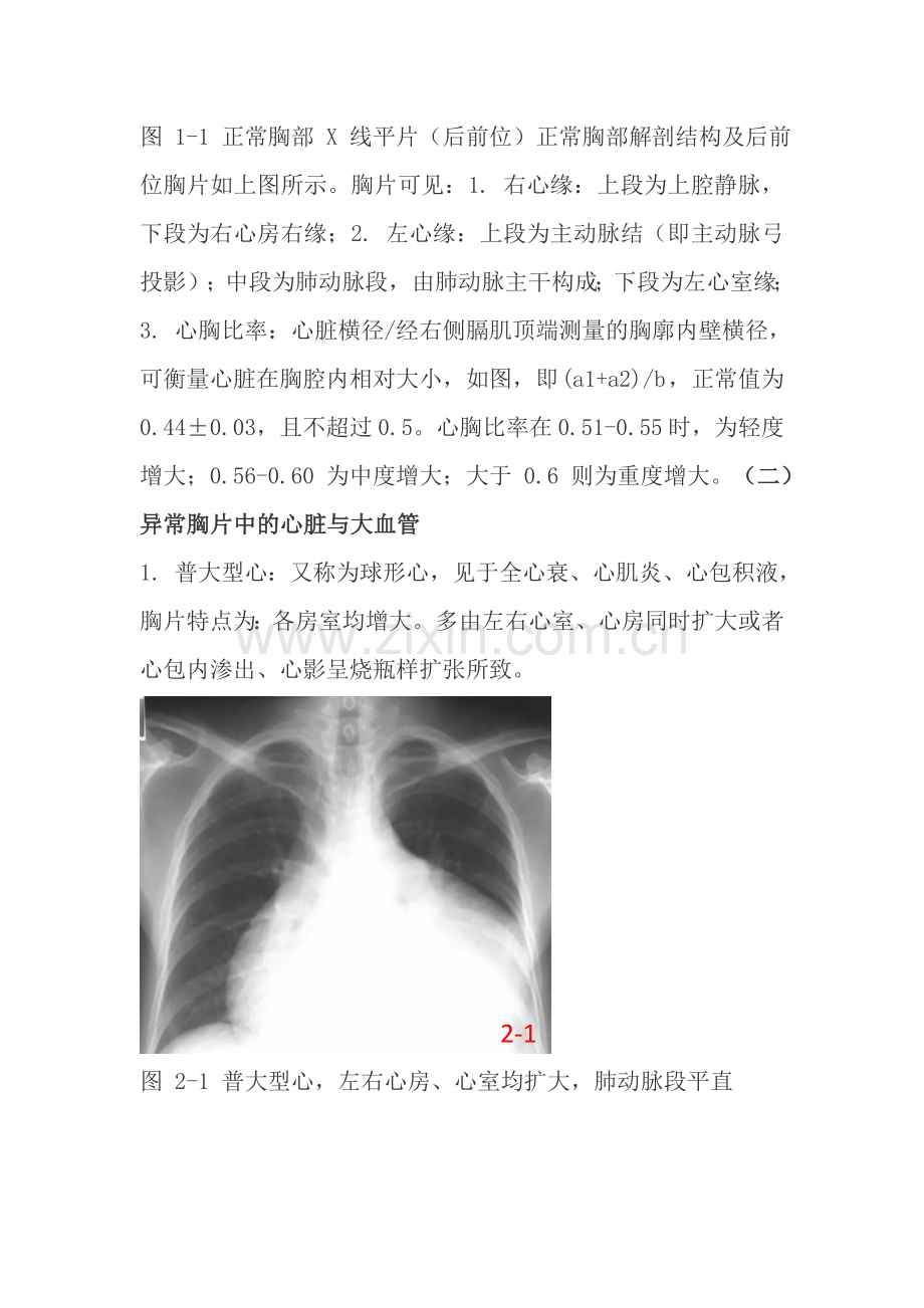 常见的X线胸片.doc_第2页