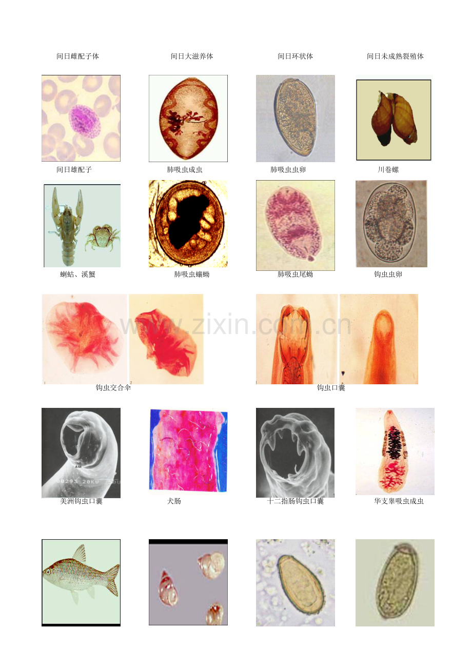 人体寄生虫学标本彩图(考试用).doc_第2页