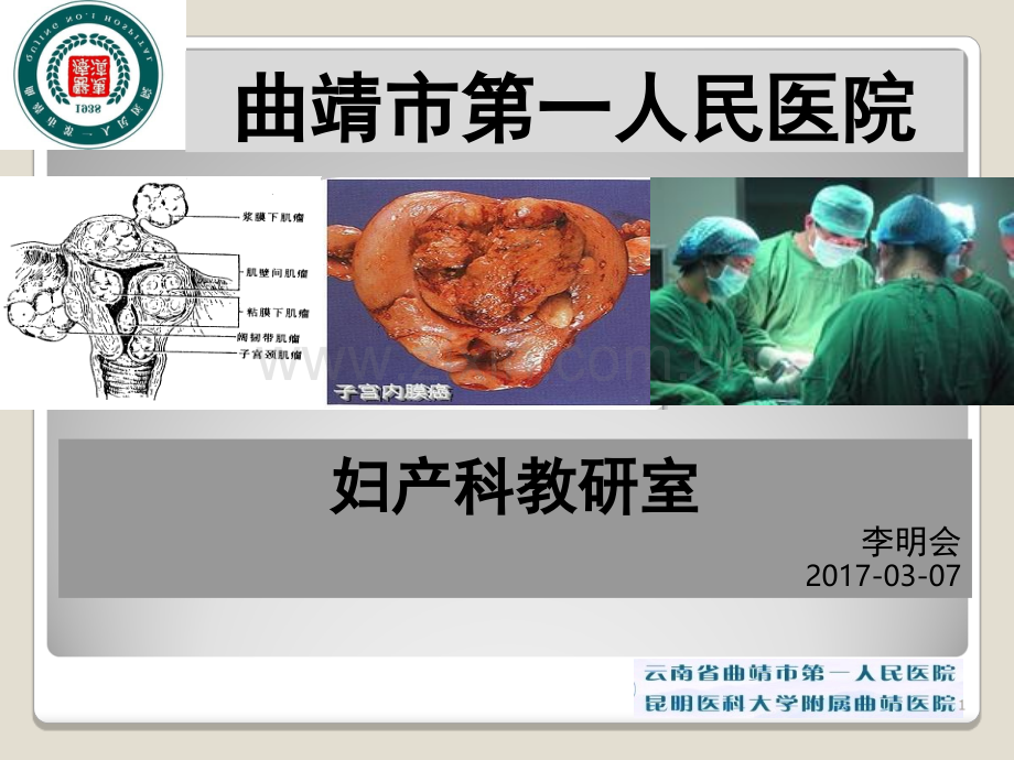 子宫肌瘤教学查房(课堂PPT).ppt_第1页