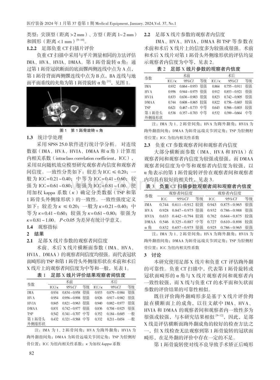 足部X线和负重CT评估踇外翻的可靠性研究.pdf_第2页