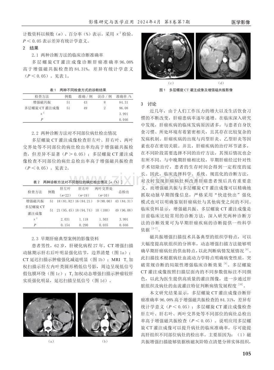 增强磁共振与多层螺旋CT灌注成像在早期肝癌诊断中的应用价值研究.pdf_第2页