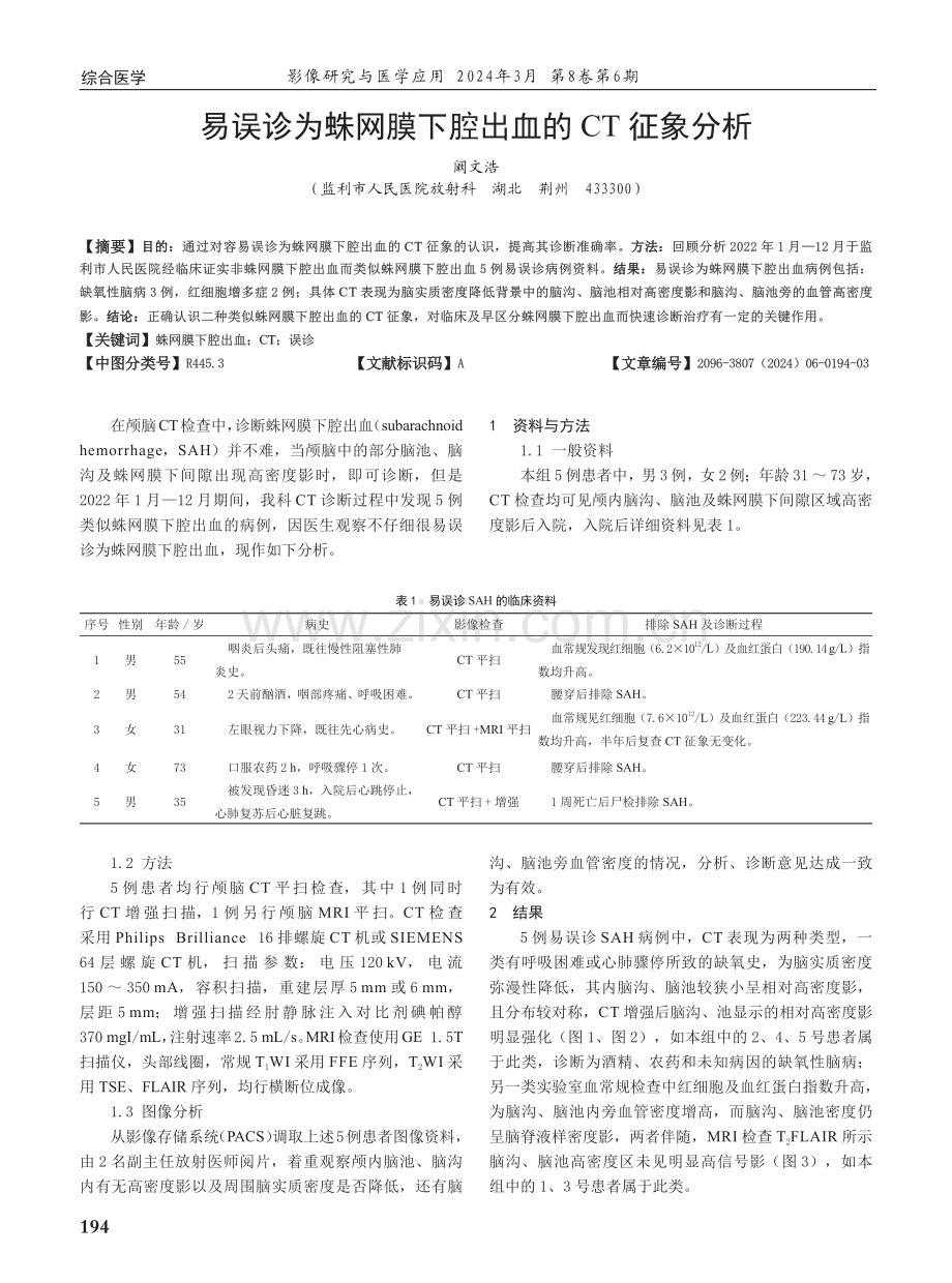 易误诊为蛛网膜下腔出血的CT征象分析.pdf_第1页