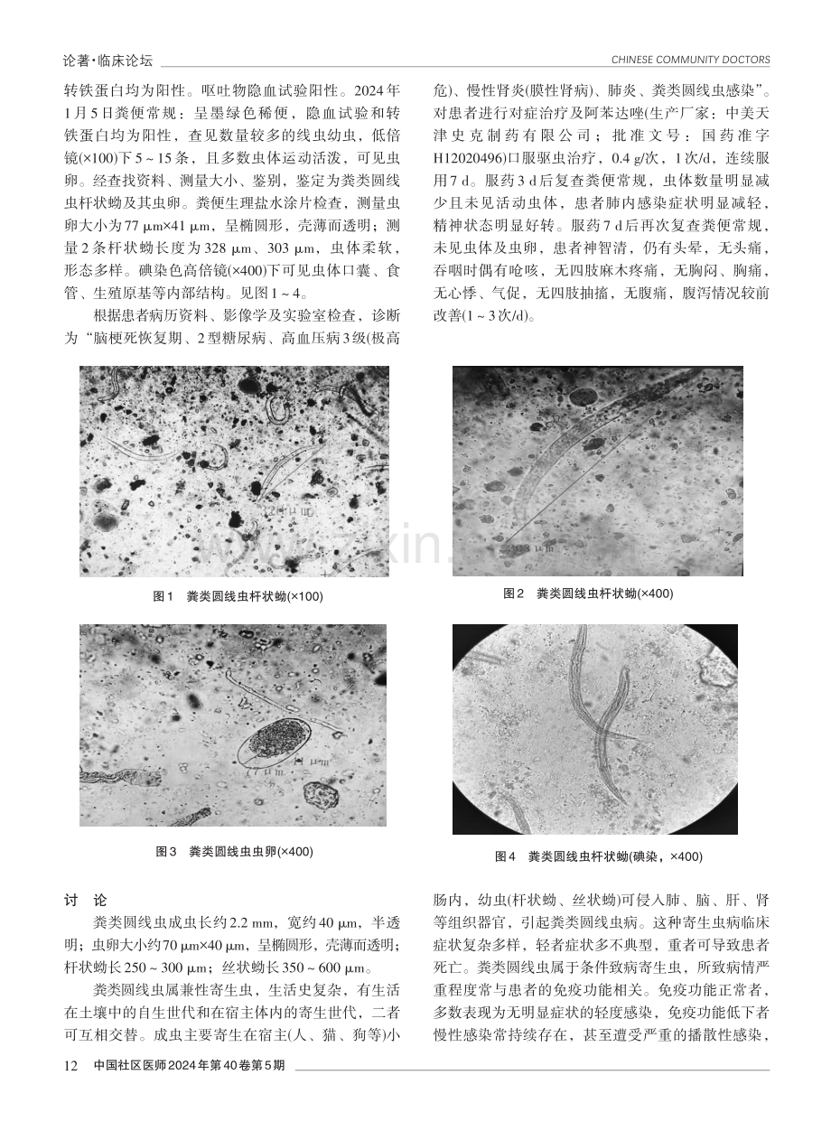 1例粪类圆线虫感染病例报告.pdf_第2页