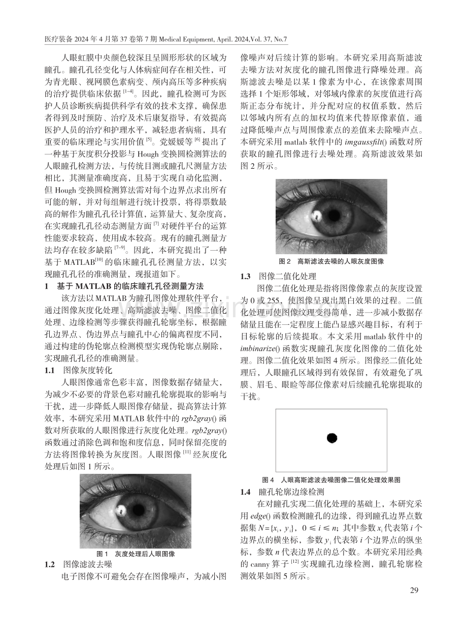 一种基于MATLAB的临床瞳孔孔径测量方法.pdf_第2页