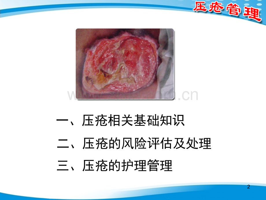 压疮管理PPT学习课件.ppt_第2页