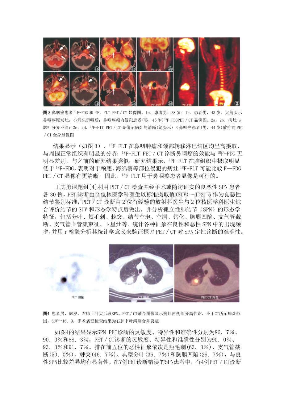 PET-CT成像技术的原理及其应用.doc_第3页