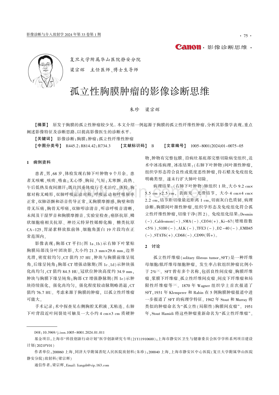 孤立性胸膜肿瘤的影像诊断思维.pdf_第1页