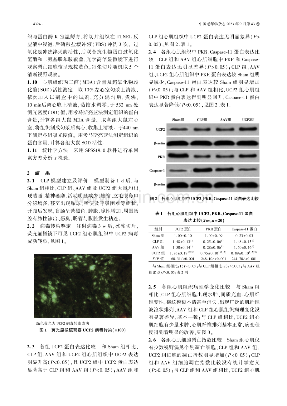 解耦联蛋白2对脓毒症腹腔感染大鼠心肌细胞凋亡、氧化应激及PKR_Caspase-11蛋白的影响.pdf_第3页