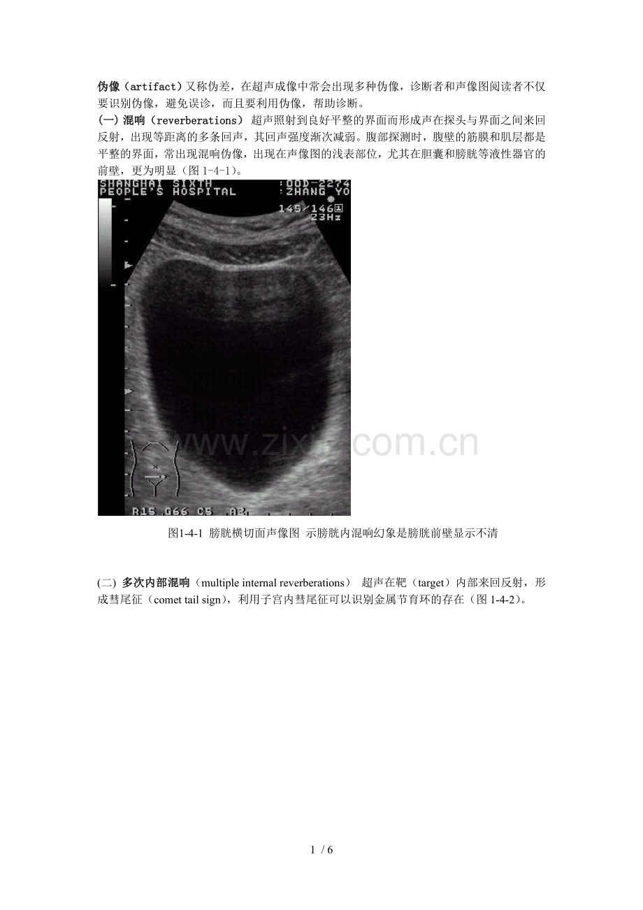 超声伪像.doc_第1页