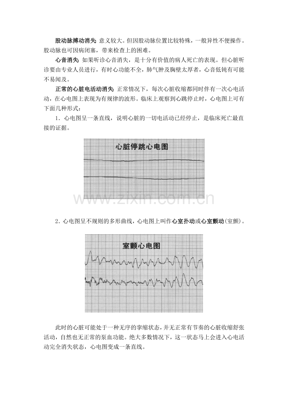 心跳骤停的心电图分型.doc_第3页