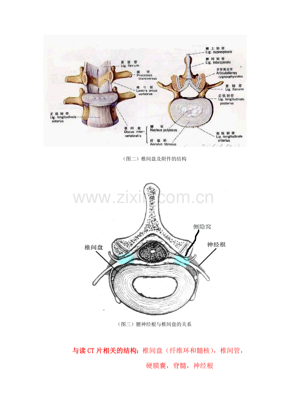 腰椎CT读片.doc_第2页