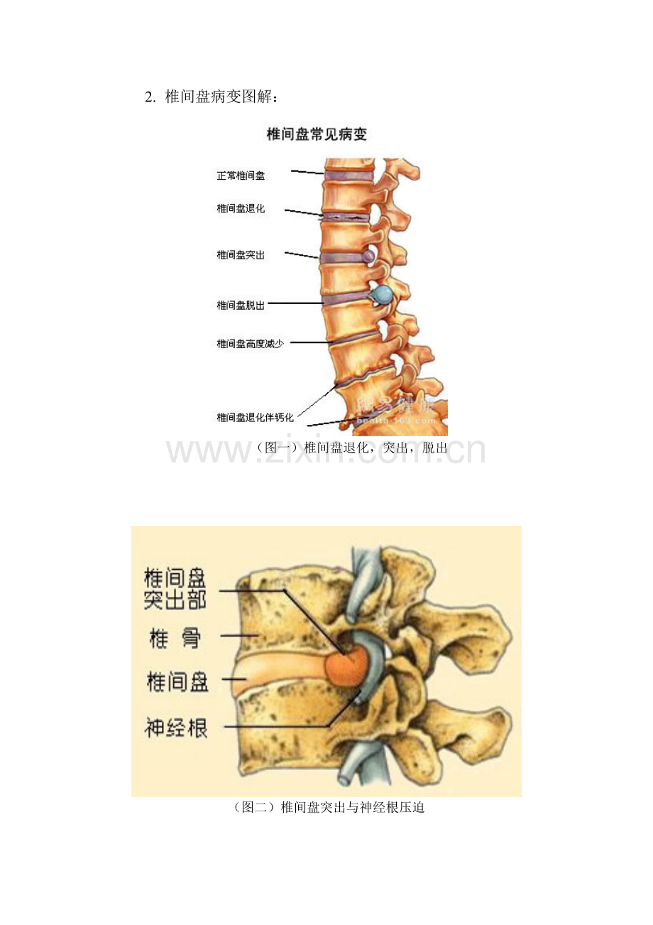 腰椎CT读片.doc_第3页