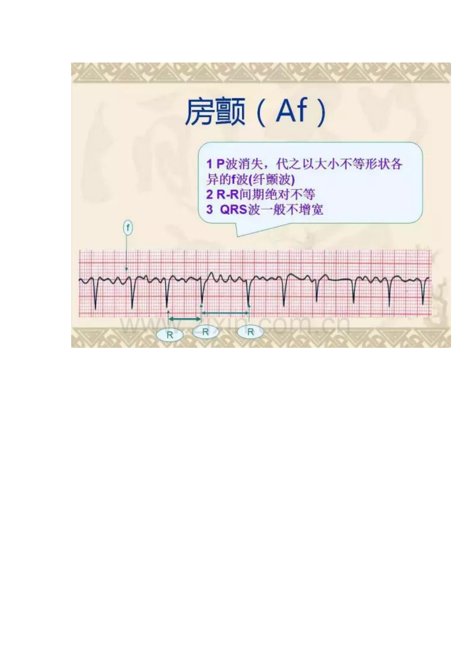 心电图的诊断思路及技巧.doc_第3页