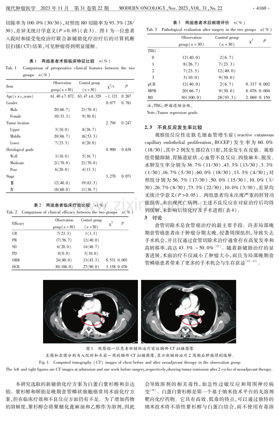 卡瑞利珠单抗联合白蛋白紫杉醇和奈达铂治疗局部晚期食管鳞癌的疗效观察.pdf_第3页