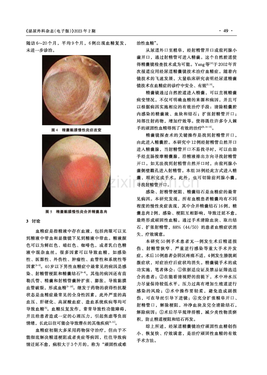 经尿道精囊镜治疗顽固性血精的临床应用效果.pdf_第3页