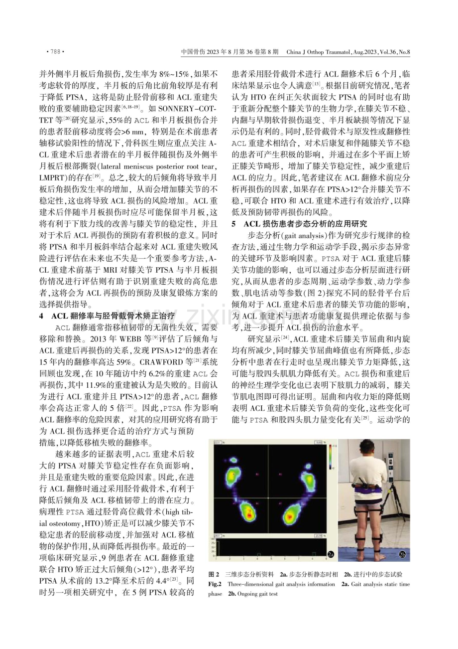 胫骨平台后倾角在前交叉韧带中的应用研究.pdf_第3页