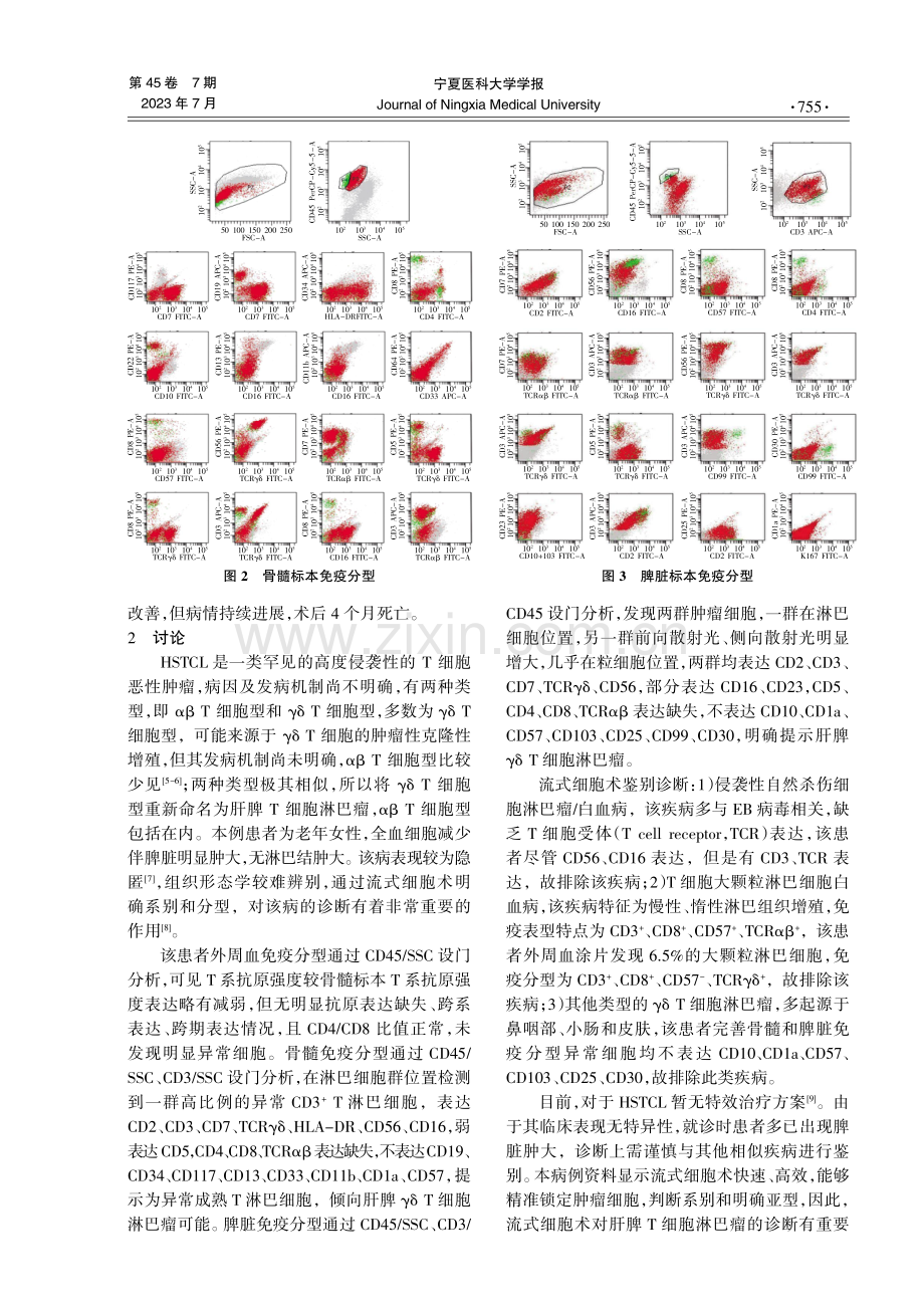 老年女性肝脾γδT细胞淋巴瘤1例并流式细胞免疫表型复习.pdf_第2页