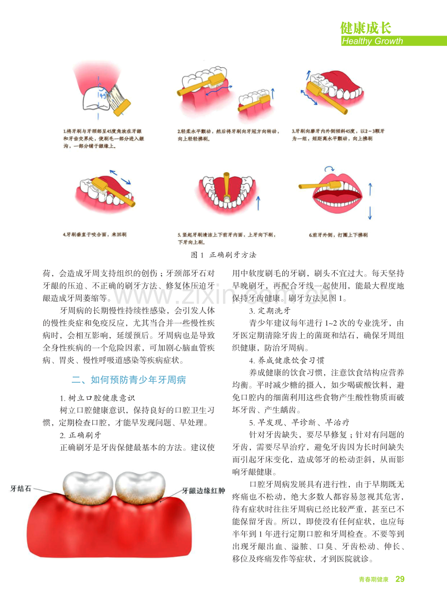 科学预防青少年牙周病.pdf_第2页