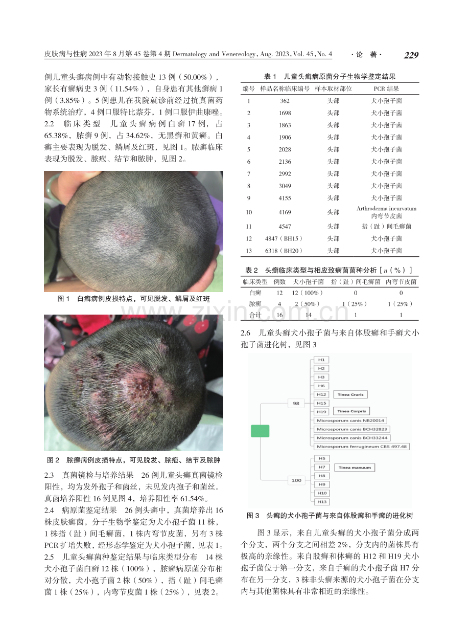 昆明地区儿童头癣临床特征与病原菌分子生物学研究.pdf_第3页