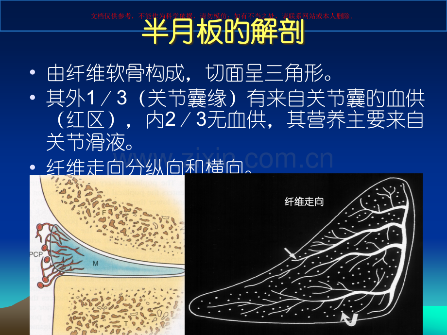 半月板损伤标准课件.pptx_第2页