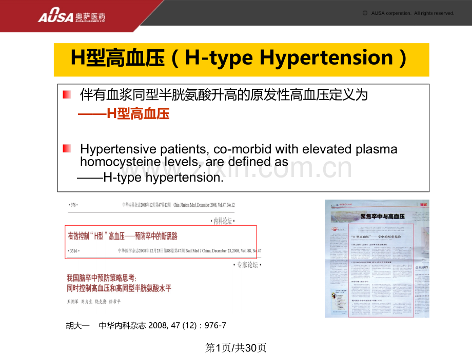 H型高血压危害.pptx_第1页