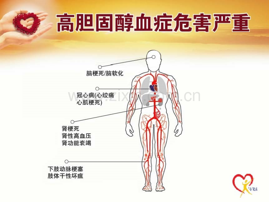 高血脂的治疗.pptx_第1页