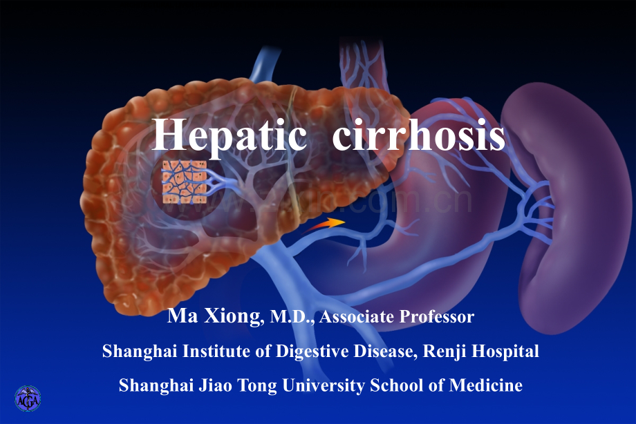 上海交通大学医学院内科学livercirrhosis.pptx_第1页