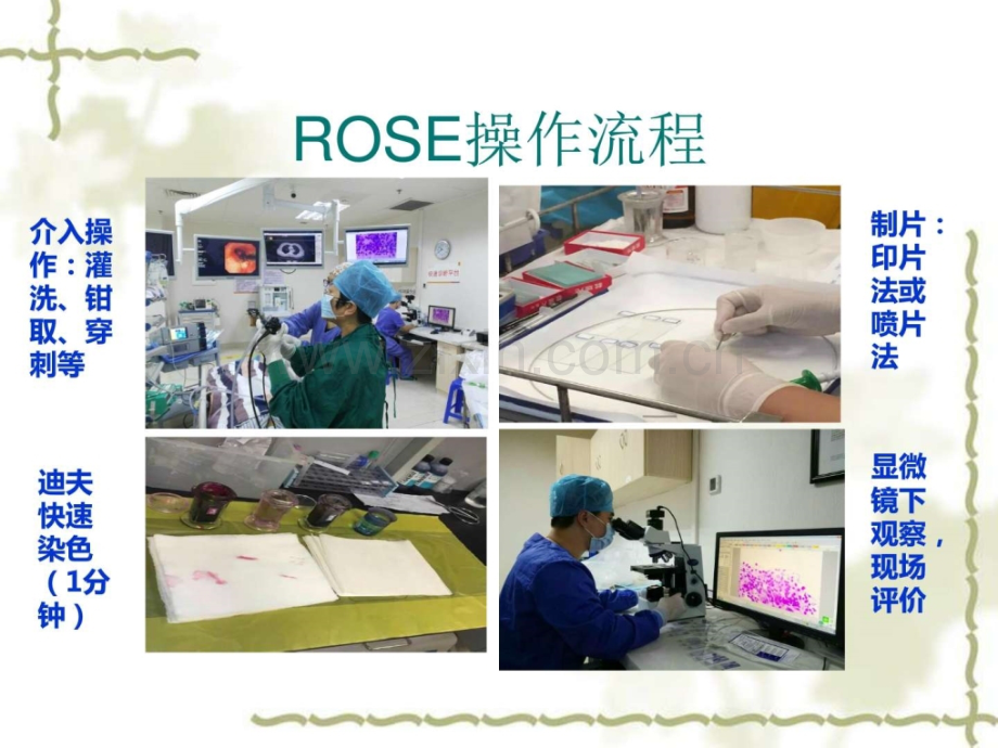 ROSE在肿瘤方面的应用.pptx_第3页