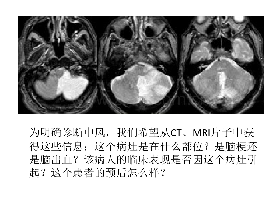 颅脑解剖.pptx_第1页